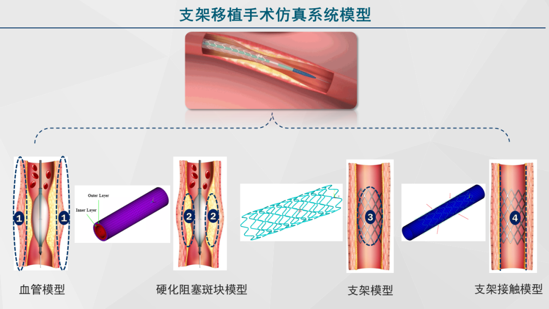 清华大学“安世亚太杯”虚拟仿真创意大赛特等奖作品开源的图9